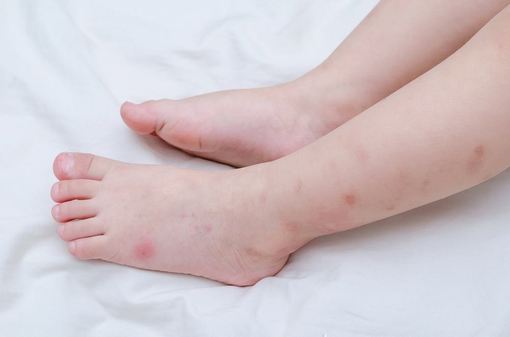 How Do I Detect That There Are Bed Bugs In My Baby’s Nursery?